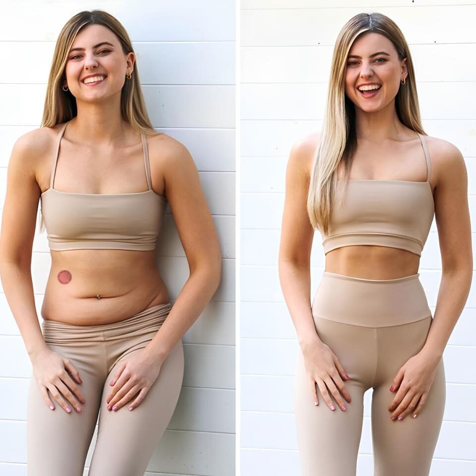 Moringa X Berberine Patches image